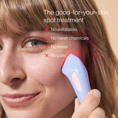 Bye Acne: 3-Minute Pimple Spot Treatment