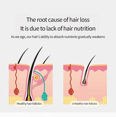 Vibration Scalp Massage Comb — Hair Growth Therapy